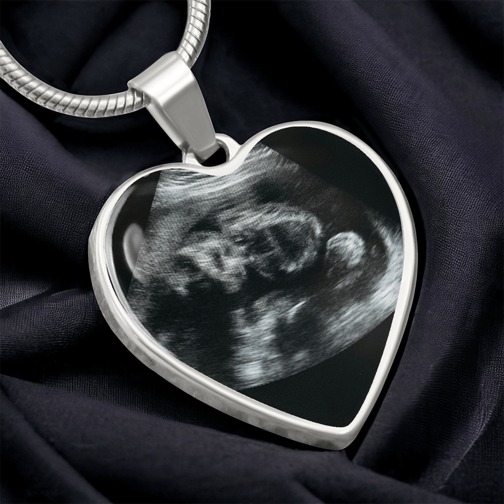 Personalized Baby Scan Photo Necklace, Engraved Baby Name Pendant, Grandma New Parent Gift, Pregnancy Announcement Picture