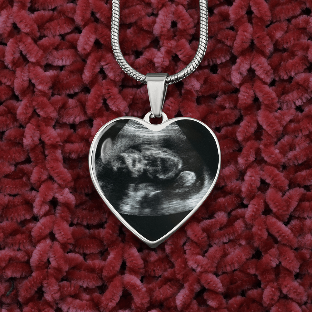Personalized Baby Scan Photo Necklace, Engraved Baby Name Pendant, Grandma New Parent Gift, Pregnancy Announcement Picture