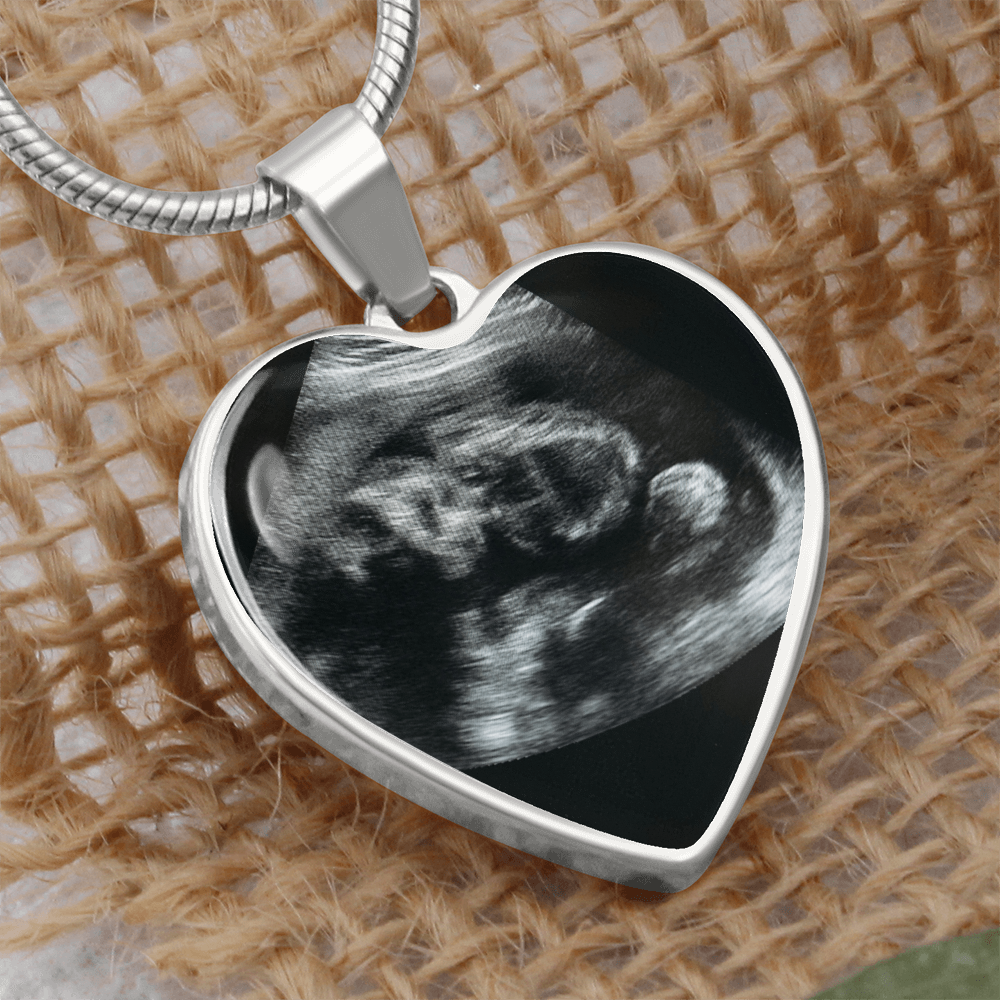 Personalized Baby Scan Photo Necklace, Engraved Baby Name Pendant, Grandma New Parent Gift, Pregnancy Announcement Picture