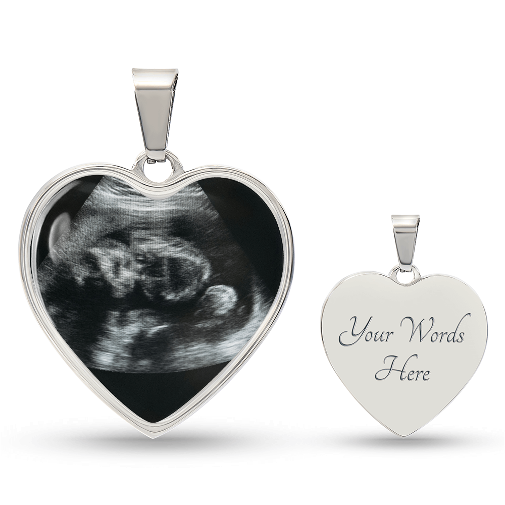 Personalized Baby Scan Photo Necklace, Engraved Baby Name Pendant, Grandma New Parent Gift, Pregnancy Announcement Picture