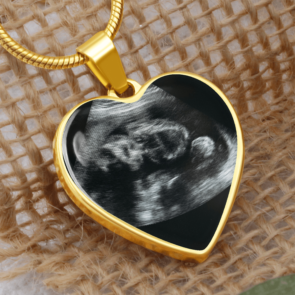 Personalized Baby Scan Photo Necklace, Engraved Baby Name Pendant, Grandma New Parent Gift, Pregnancy Announcement Picture