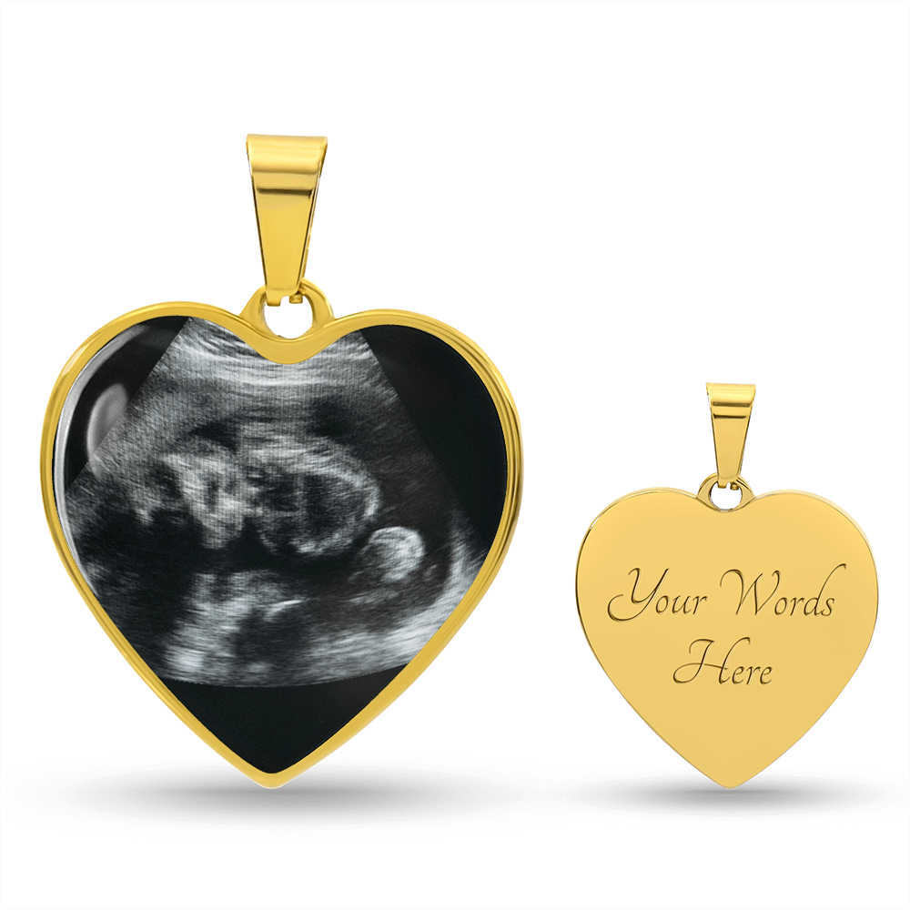 Personalized Baby Scan Photo Necklace, Engraved Baby Name Pendant, Grandma New Parent Gift, Pregnancy Announcement Picture