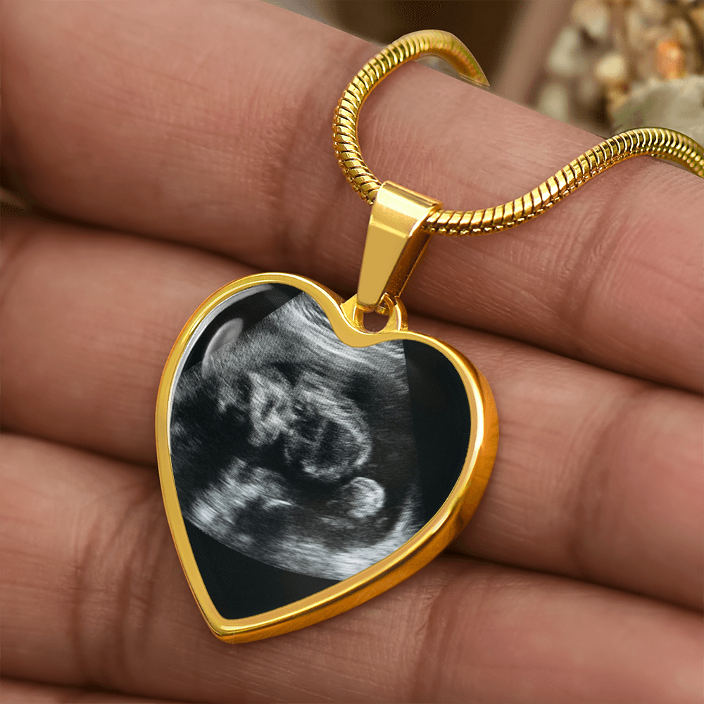 Personalized Baby Scan Photo Necklace, Engraved Baby Name Pendant, Grandma New Parent Gift, Pregnancy Announcement Picture